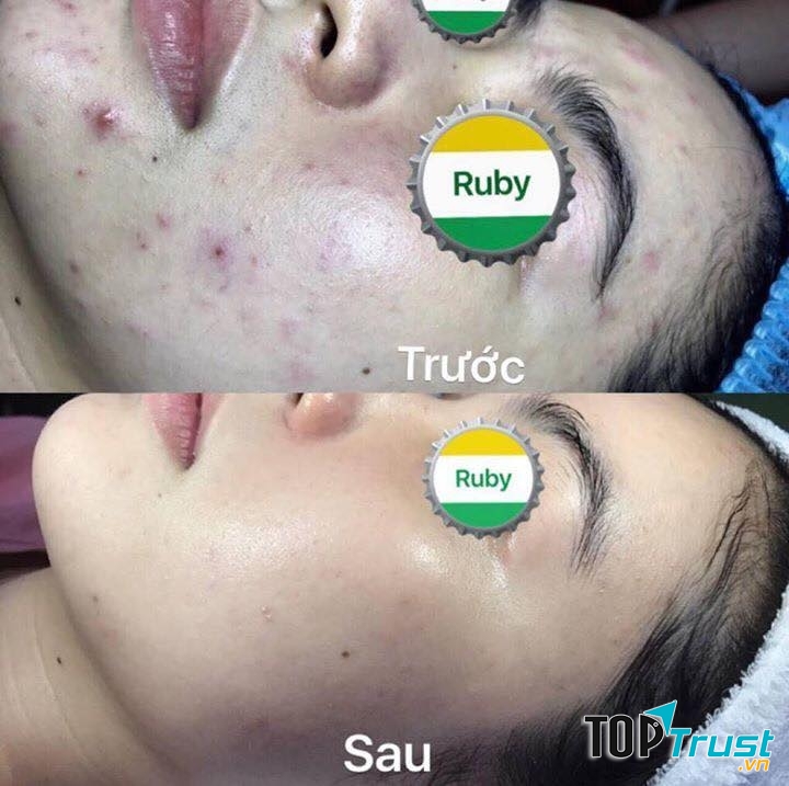 Ruby Spa