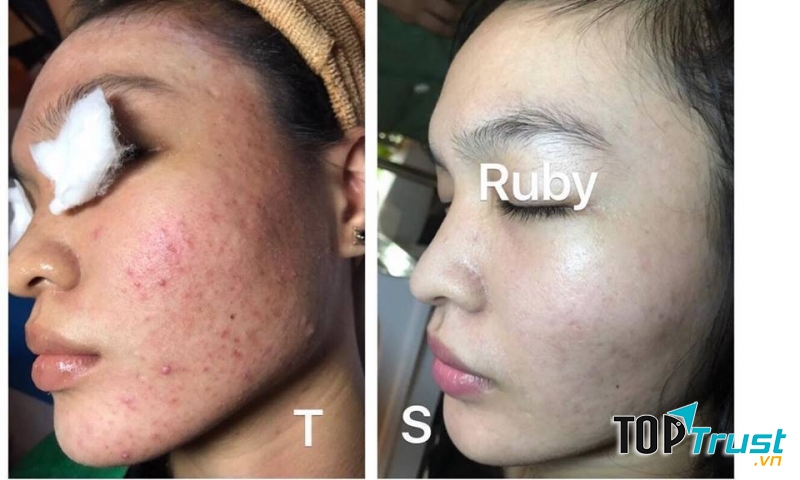 Ruby Spa