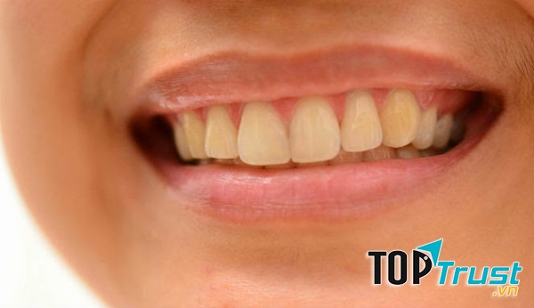 Ảnh minh họa - nguồn internet