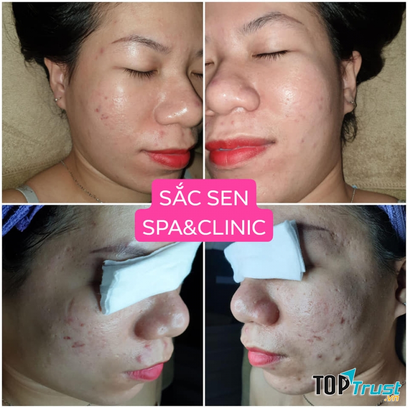 Sắc Sen Spa