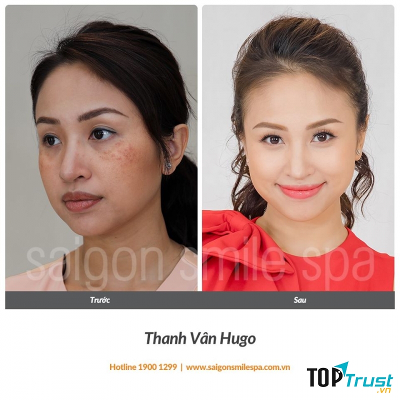 SAIGON SMILE SPA