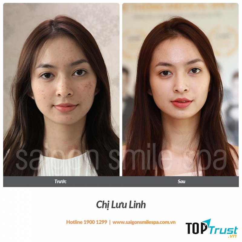 SAIGON SMILE SPA