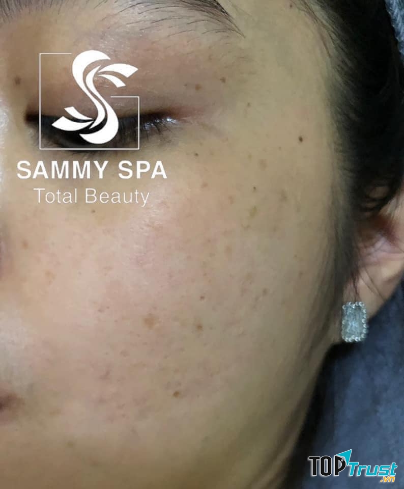 Sammy Spa