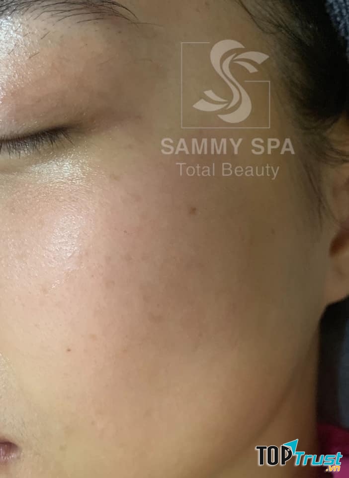 Sammy Spa