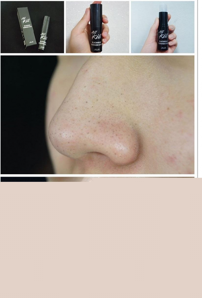 Sáp trị mụn đầu đen RiRe All Kill Blackhead Remover Stick cho thấy khả năng loại bỏ mụn đầu đen, mụn cám, mụn đầu trắng, bã nhờn, dầu thừa, tế bào chết trên da một cách hiệu quả