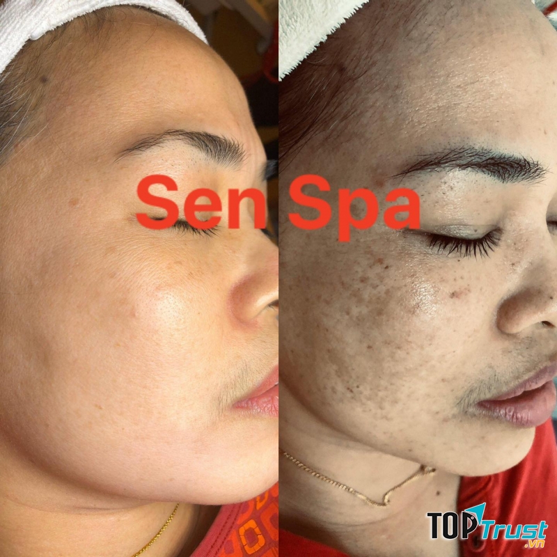 Sen Spa