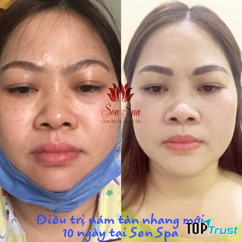 Sen Spa Bình Dương
