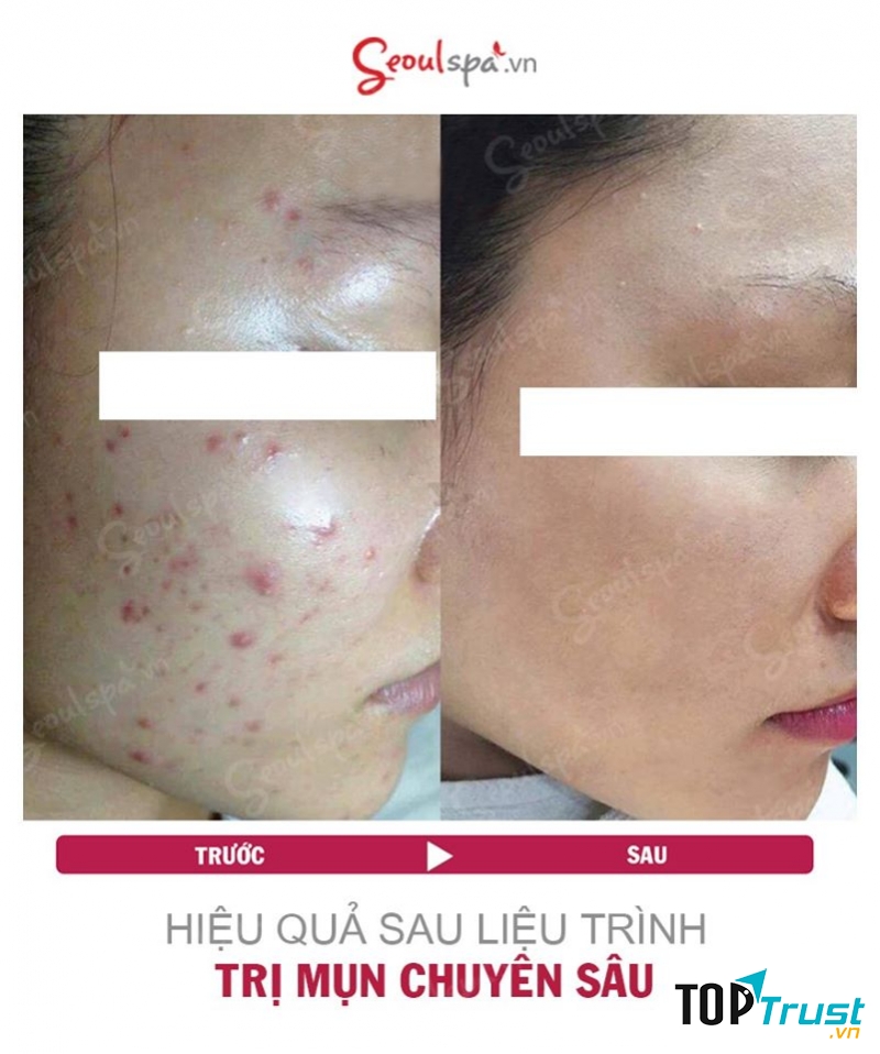 Seoul Spa Đà Lạt