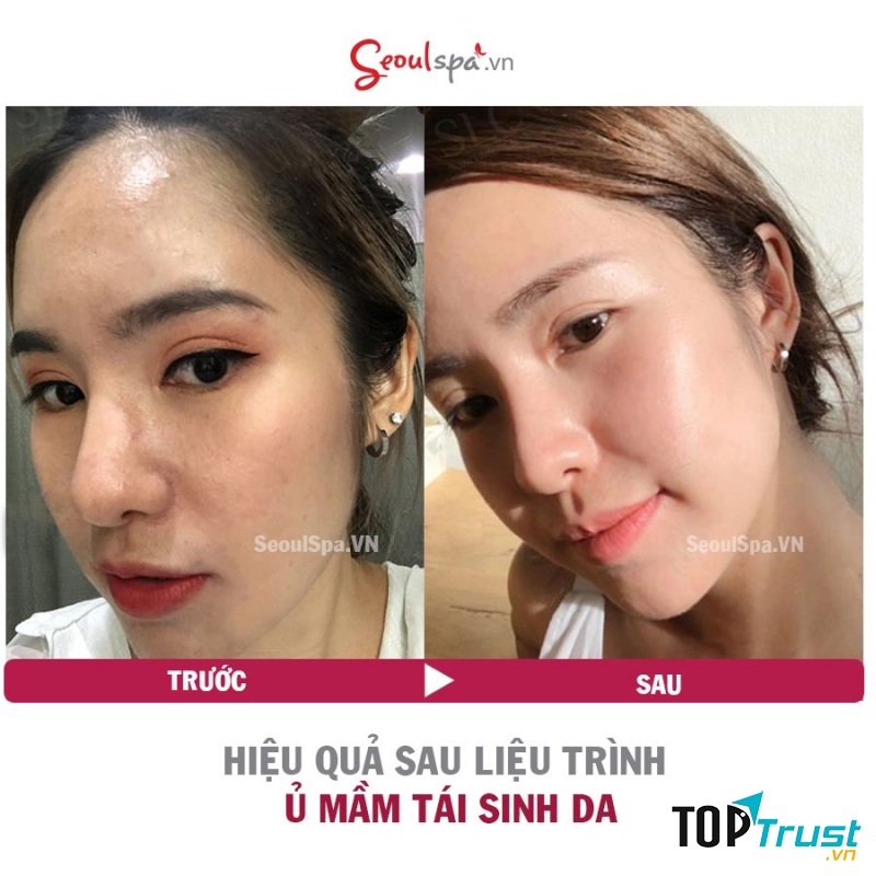 Seoul Spa Đà Lạt