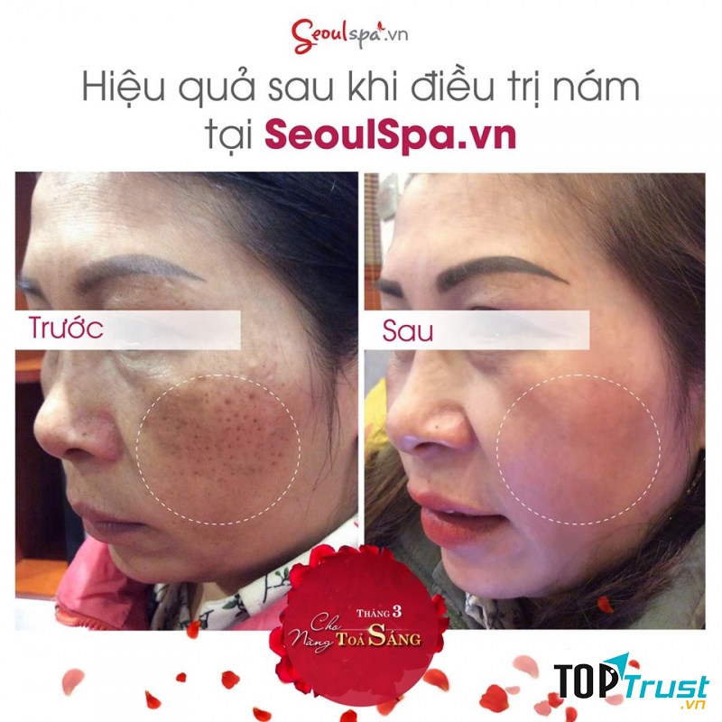 SeoulSpa