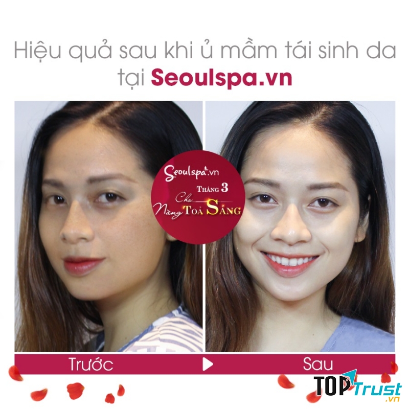 SeoulSpa.Vn Đà Lạt