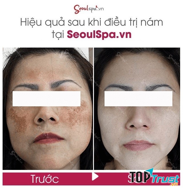SeoulSpa.Vn Long Xuyên