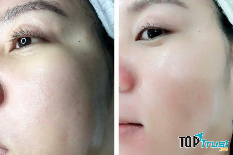 Estee Lauder Advanced Night Repair Ampoules viên nang