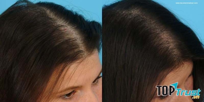 Kaminomoto EX giúp thúc đẩy quá trình hình thành, kích thích mạnh mẽ đến sự phát triển của tóc mới bằng cách kích hoạt sợi tóc cung cấp dinh dưỡng cho chân tóc