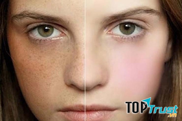 Serum Trị Nám, Dưỡng Trắng, Chống Lão Hóa Maria Galland Anti-Pigmentation Birghtening Serum D-520 Làm giảm số lượng melanin từ sâu bên trong để ngăn ngừa và làm mờ nhanh chóng các vết nám, tàn nhang, đốm nâu