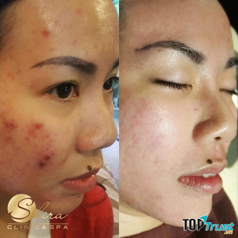 Shira Clinic & Spa