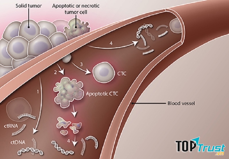 Thành tựu mới trong chẩn đoán và chăm sóc bệnh nhân ung thư