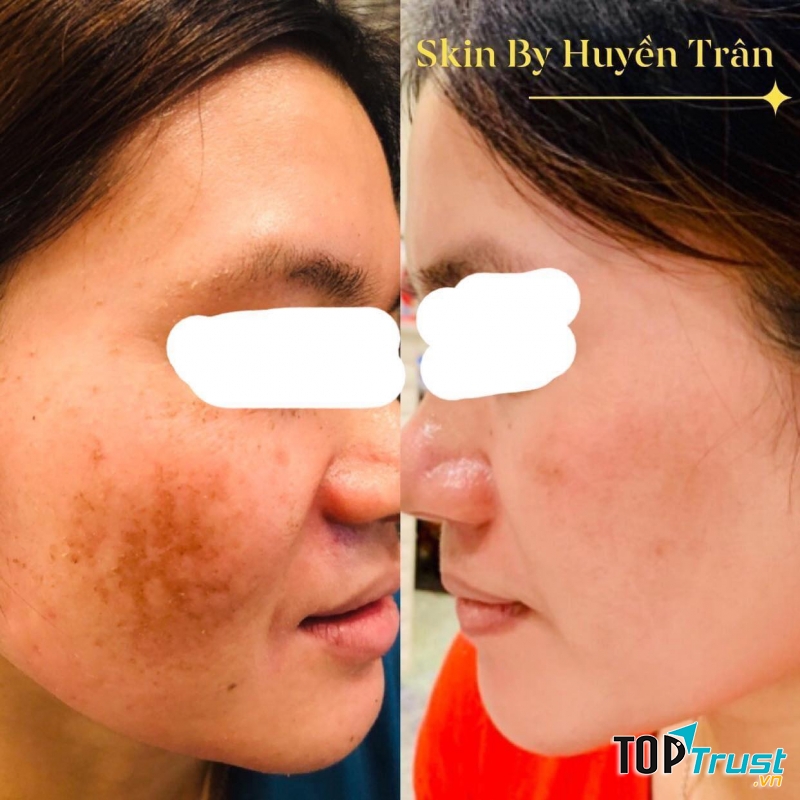 Skin by Huyen Tran Spa