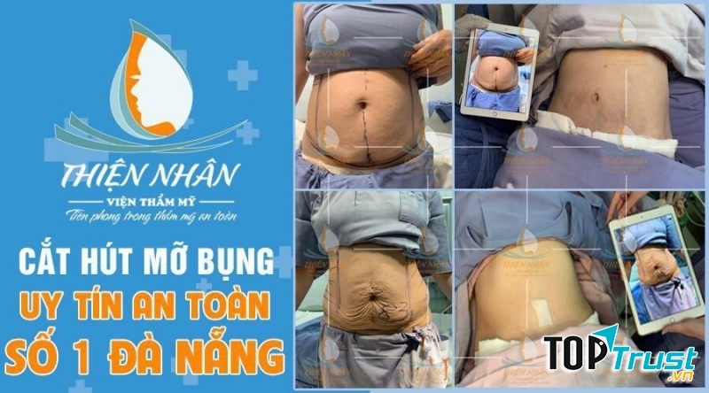 Công nghệ OPT-Elight thế hệ mới số 1 Hoa Kỳ được ứng dụng tại Skincare Thiện Nhân