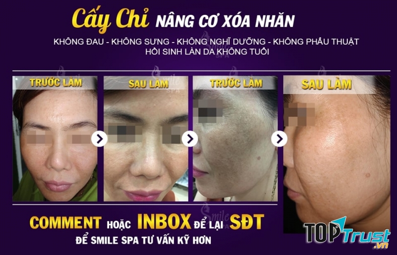 Smile Spa