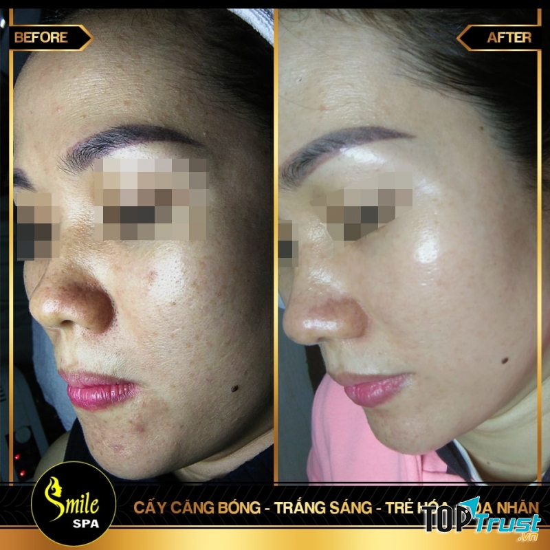 Smile Spa