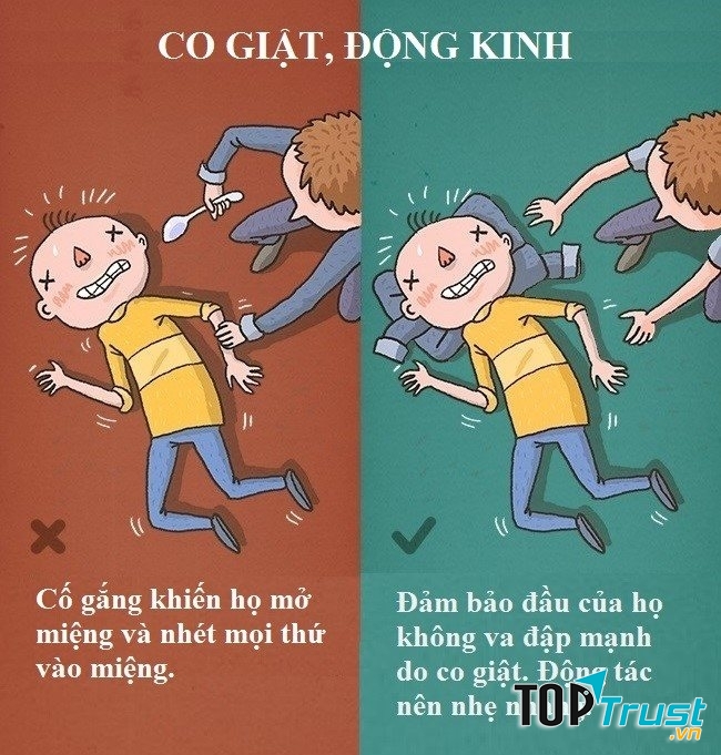 Sơ cứu người bị động kinh