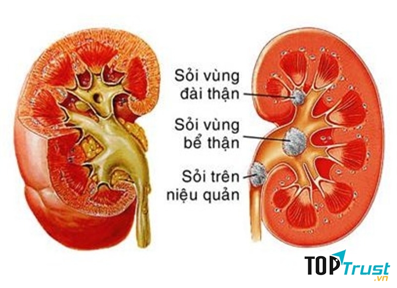 Ảnh minh họa (Nguồn Internet)