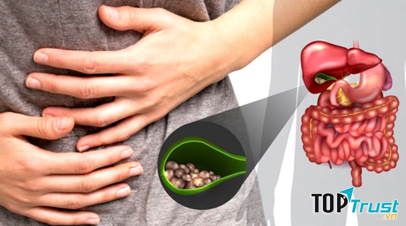 Ảnh minh họa (Nguồn Internet)