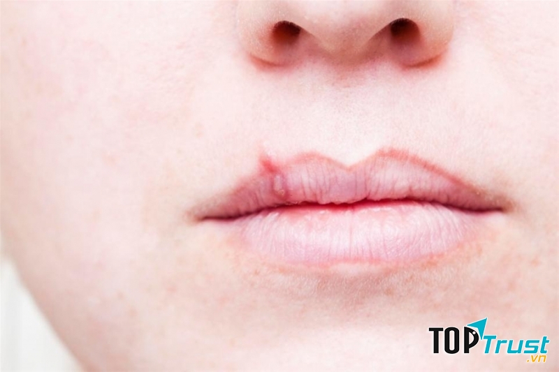 Son môi được sản xuất với nhiều thành phần, trong đó có cả những chất hoá học và kim loại, đặc biệt là chì.