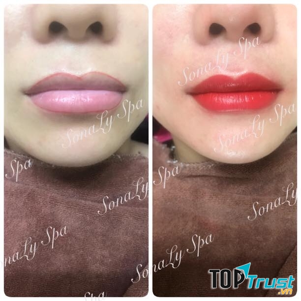 SonaLy Spa 373 Bà Triệu - Lạng Sơn