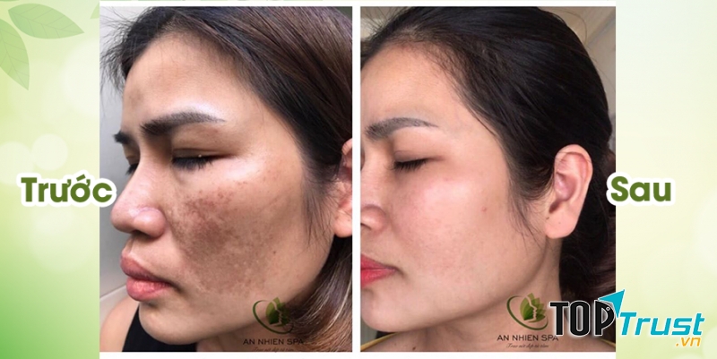 Spa An Nhiên - Bà Rịa