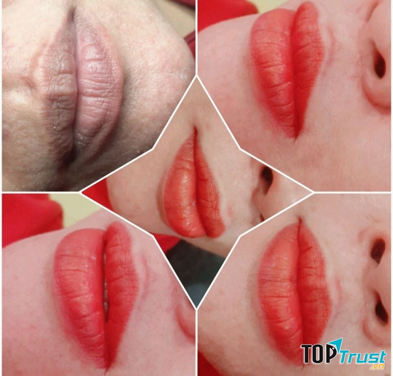 Spa Bác sỹ Nương