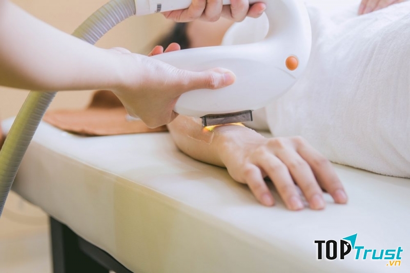 Khách hàng trải nghiệm dịch vụ tẩy lông tại Belas spa