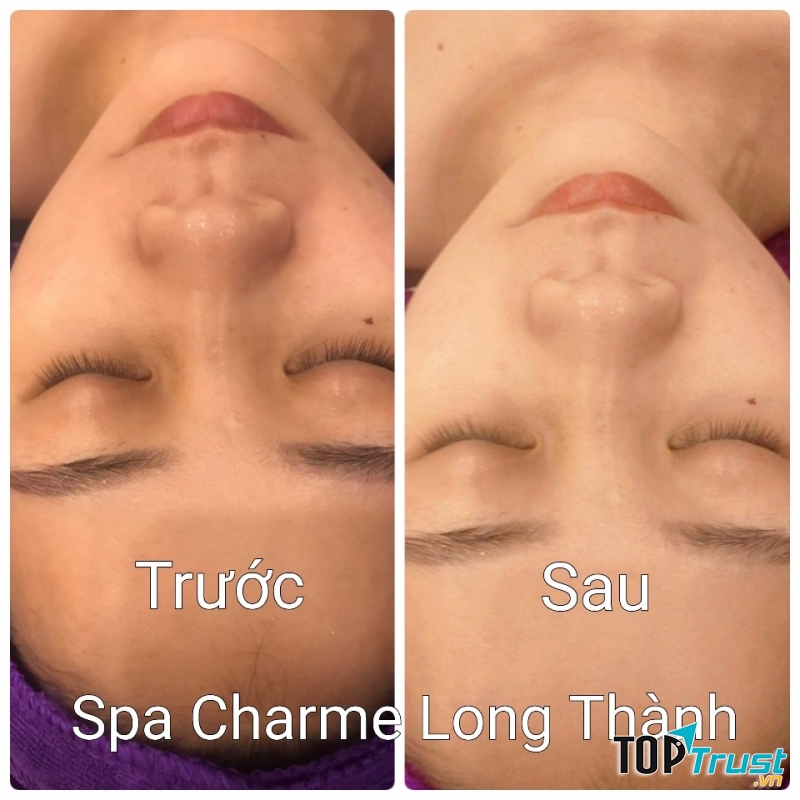 Spa Charme