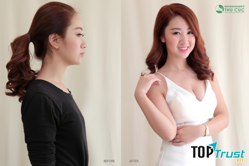 Thẩm mỹ Thu Cúc Sài Gòn