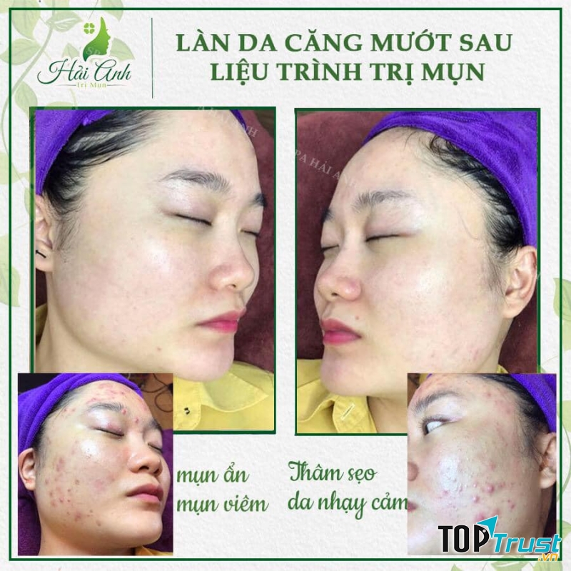 Spa Hải Anh