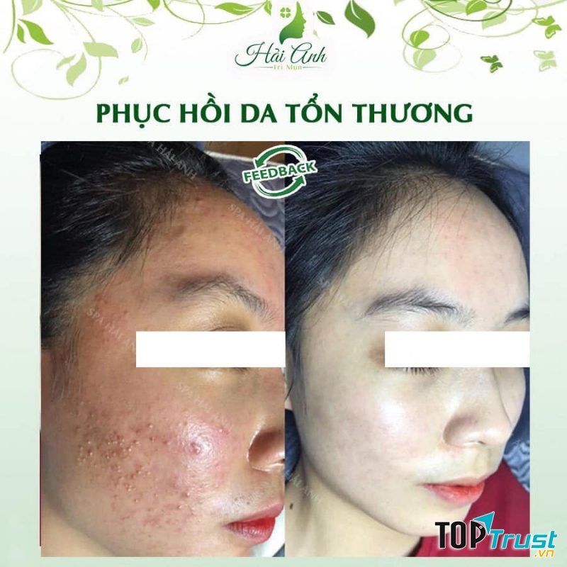 Spa Hải Anh