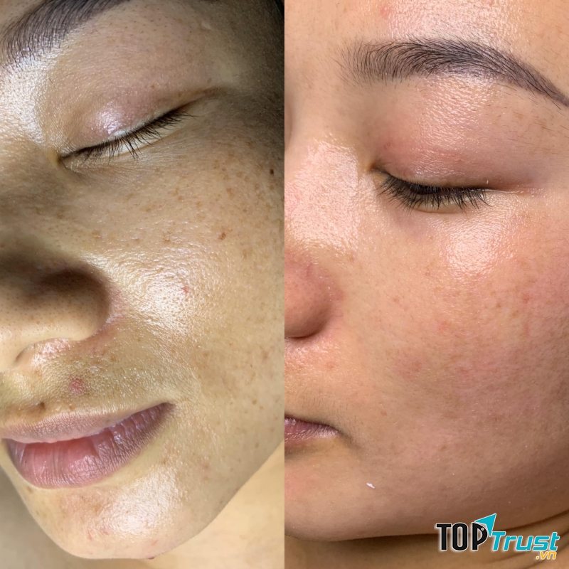 SPA Hải Băng Beauty