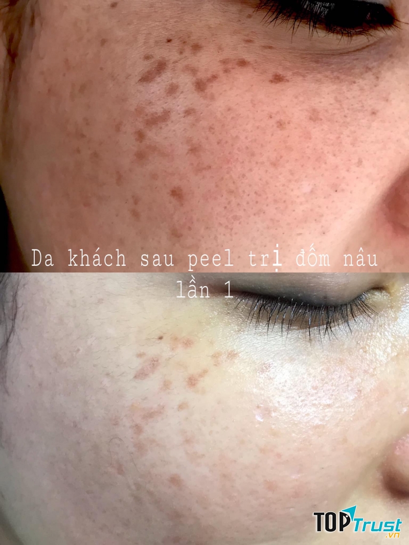 Spa Hảo Mi