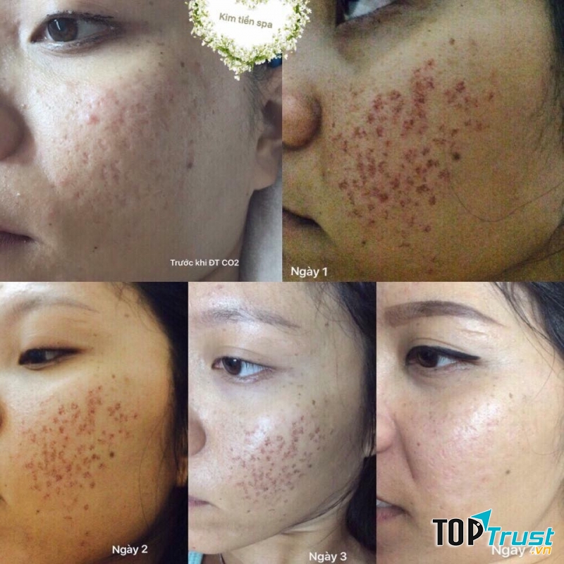 Spa Kim Tiền 2