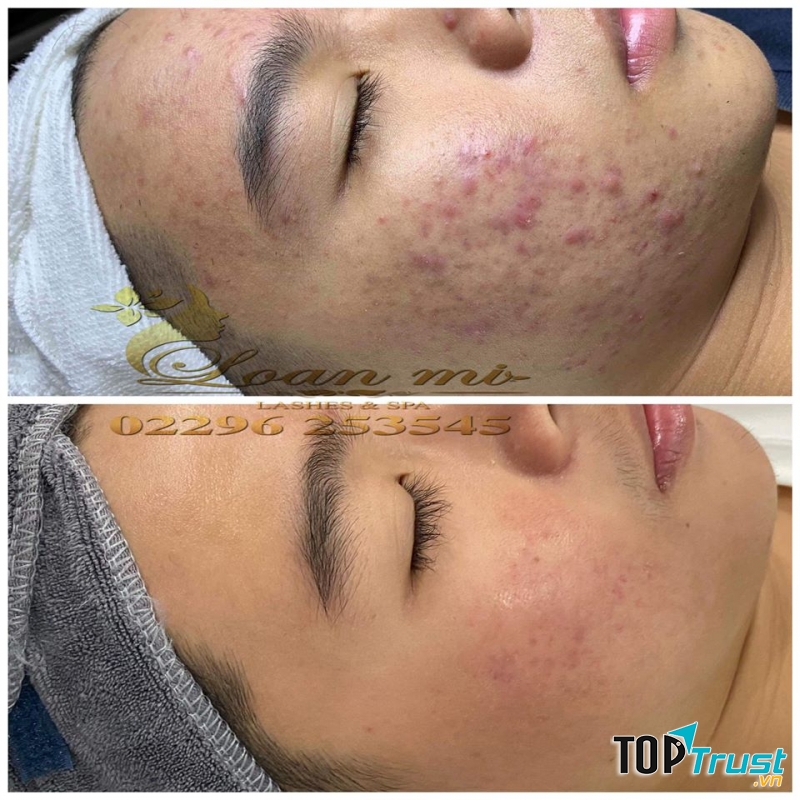 Spa Loan Mi
