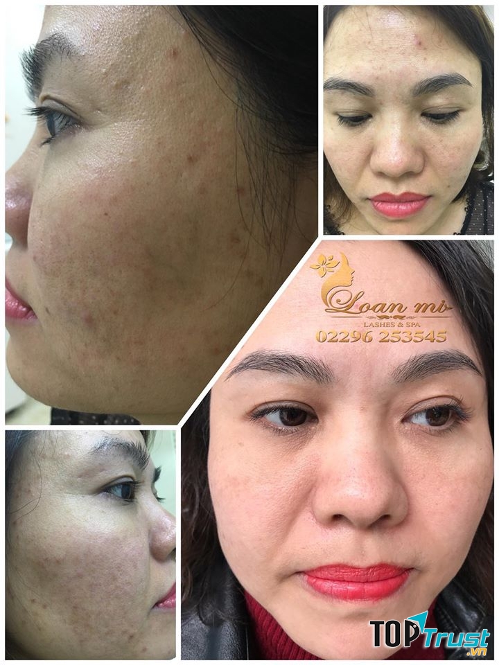 Spa Loan Mi