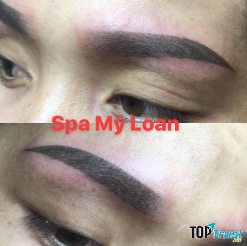 Spa Mỹ Loan