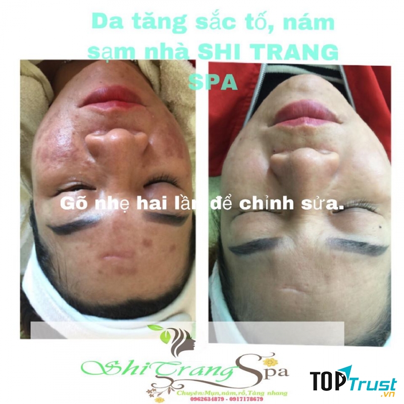 Spa Shi Trang