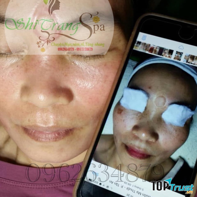 Spa Shi Trang