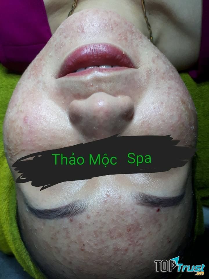 Spa Thảo Mộc