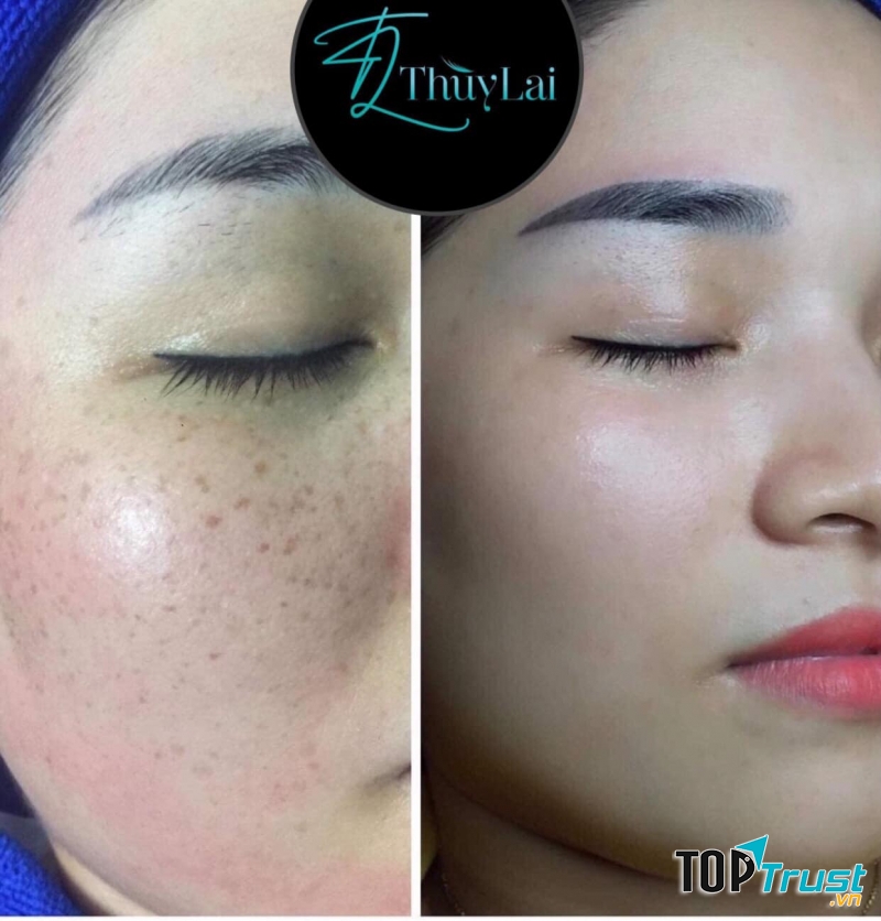 Spa Thùy Lai Long Khánh