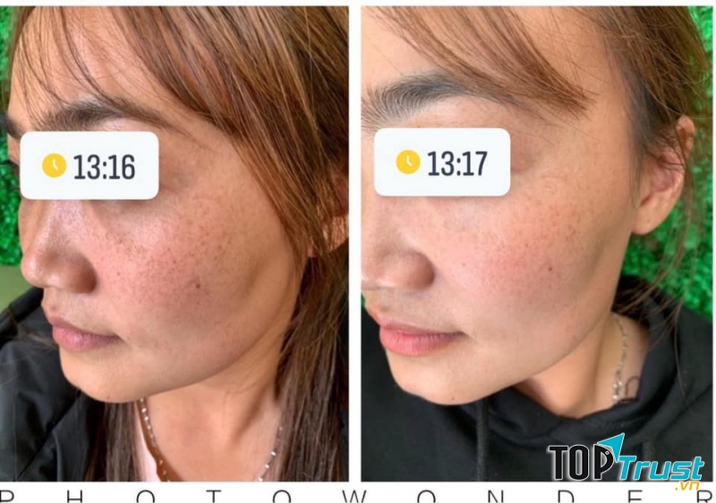 Spa Thuỷ Mộc Đà Lạt