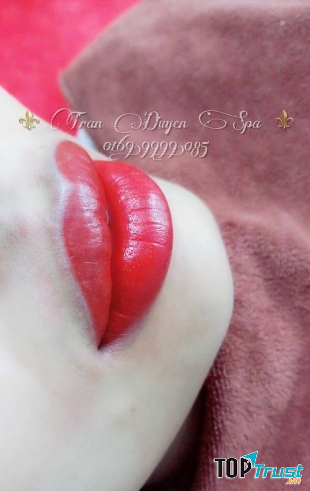 Spa Trần Duyên