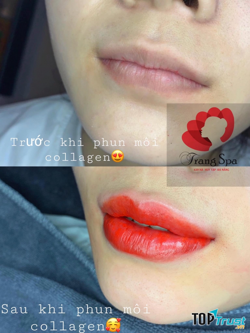 Spa Trang - Đà Nẵng